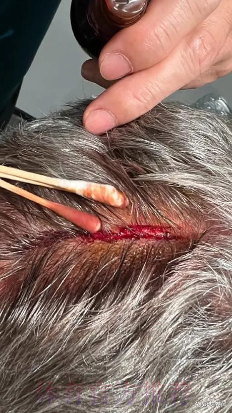 记者:安帅希望启用迪亚斯 米兰冬窗后才会和皇马商谈